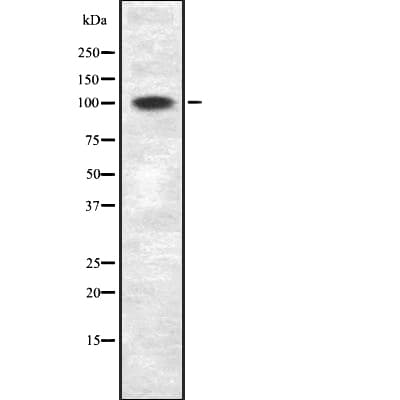 Polyclonal Rabbit anti-Human ZNF217 Antibody (WB)