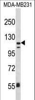 Polyclonal Rabbit anti-Human ITGAX / CD11c Antibody (aa1119-1145, IHC, IF, WB)