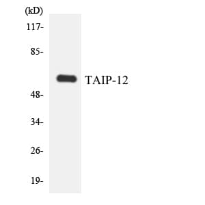 CSRNP2 / FAM130A1 Antibody (aa78-127)