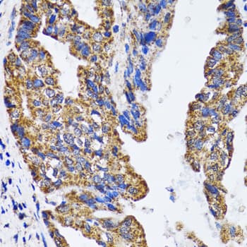 TP53 / p53 Antibody