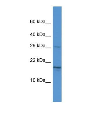 Polyclonal Rabbit anti-Human HN1 / ARM2 Antibody (aa61-110, WB)
