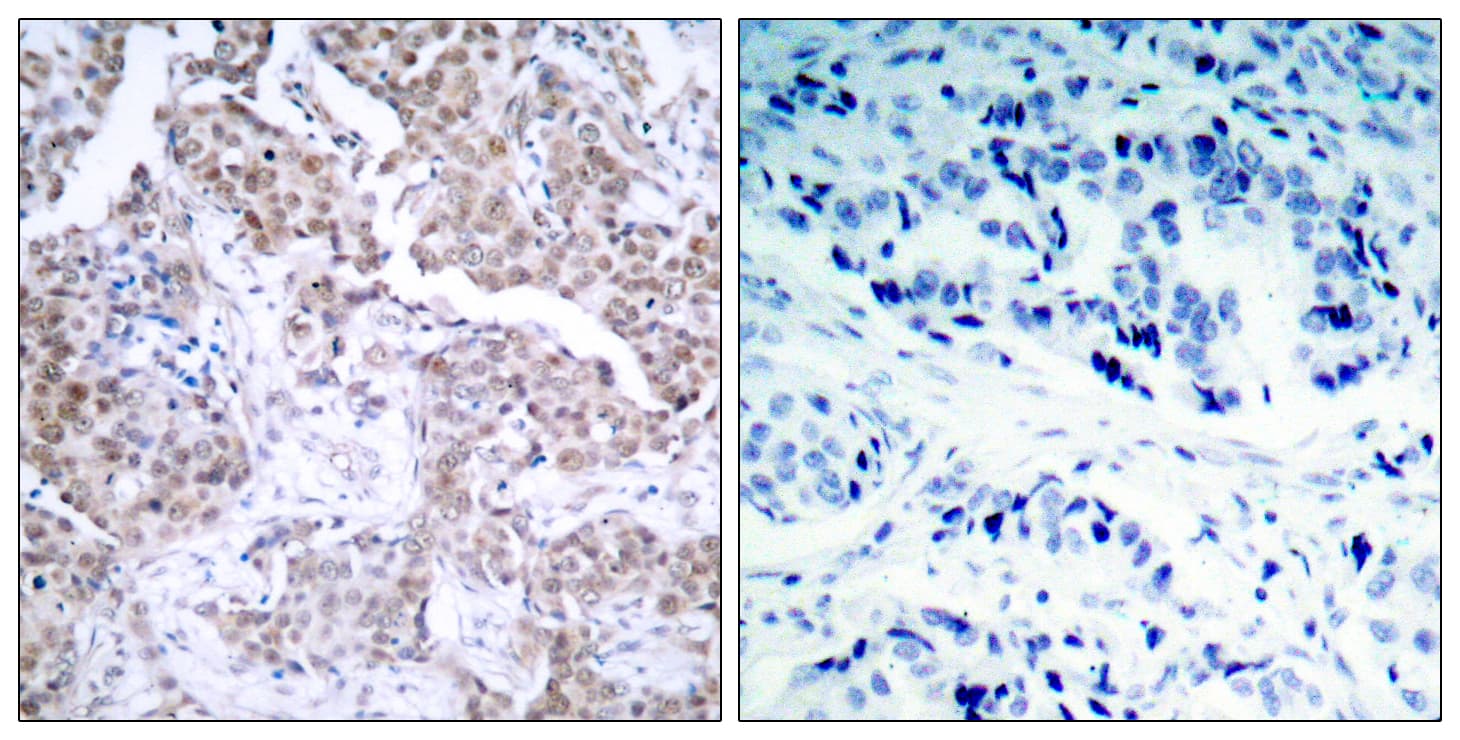 TP53 / p53 Antibody (phospho-Ser15)