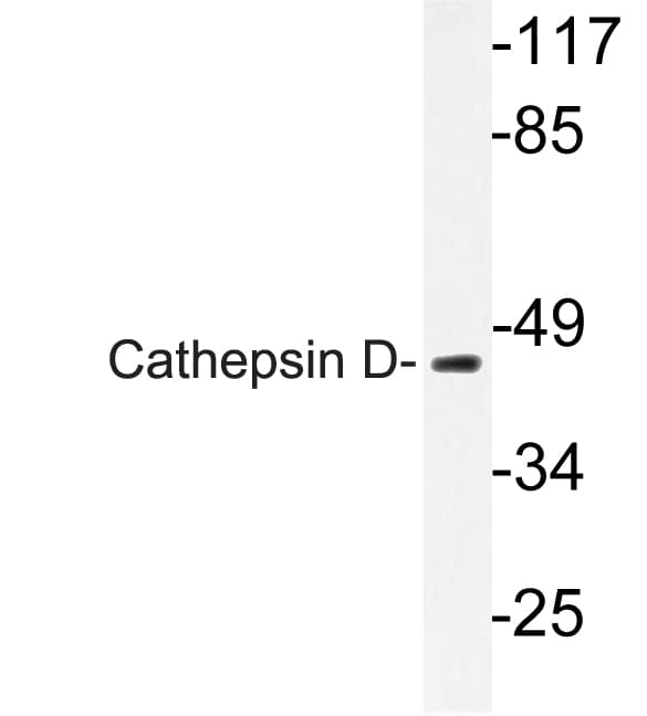 CTSD / Cathepsin D Antibody (Lys345)