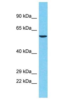 Polyclonal Rabbit anti-Human POTEA / POTE8 Antibody (aa325-374, WB)
