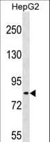 Polyclonal Rabbit anti-Human TSC22D2 Antibody (aa34-62, IF, WB)