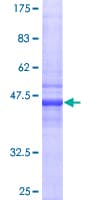Human CRADD / RAIDD Protein (Recombinant GST)