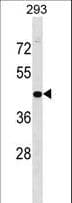 GPN1 / XAB1 Antibody (aa325-352)
