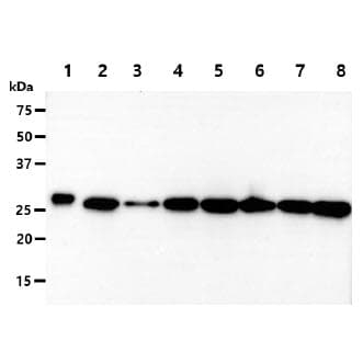 PGAM2 Antibody (clone AT5A7)