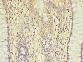 AGBL2 / CCP2 Antibody