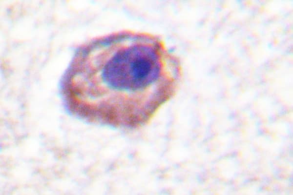 MLC2 / MYL9 Antibody (Pro13)