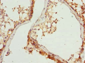 RAB31 Antibody