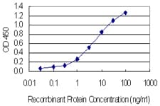 Monoclonal Mouse anti-Human SSX4 Antibody (clone 3E10, IF, WB)