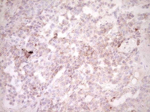 Monoclonal Mouse anti-Human CTGF Antibody (clone OTI2C9, aa27-349, IHC)