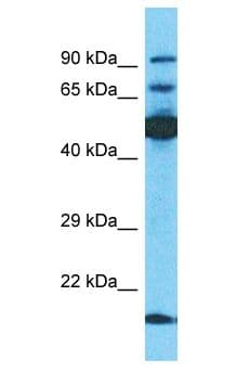 TBKBP1 Antibody (aa504-553)