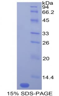Mouse Ccl12 / MCP5 Protein (Recombinant His)