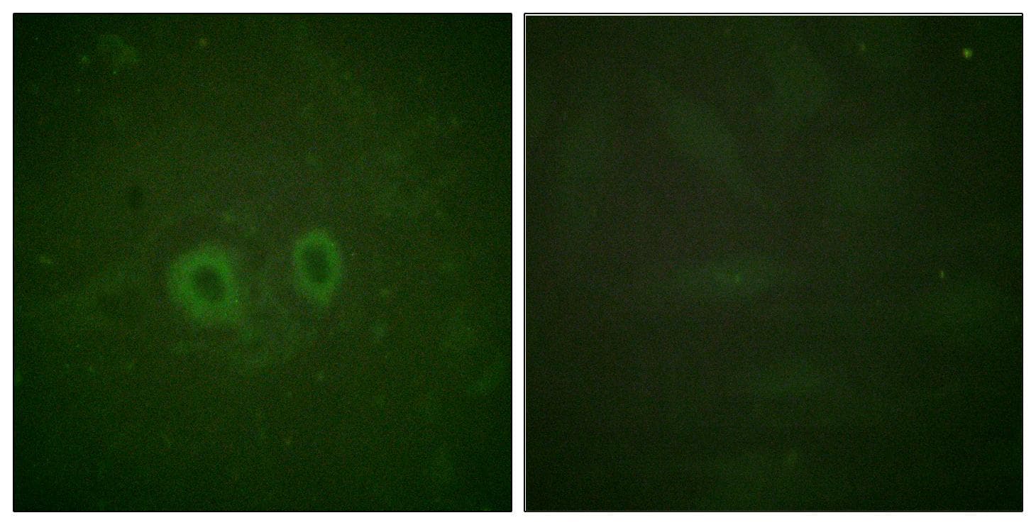 RET Antibody (p905)