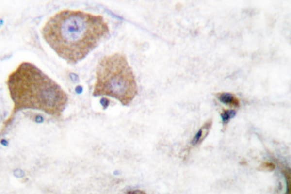 Polyclonal Rabbit anti-Human MAPT / Tau Antibody (phospho-Ser396, IHC, WB)