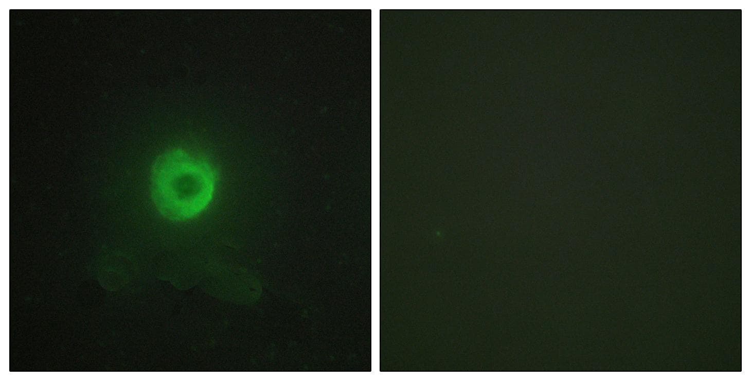 TNFRSF1B / TNFR2 Antibody