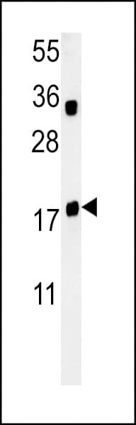 Polyclonal Rabbit anti-Human TRAPPC6A Antibody (aa34-62, IHC, WB)
