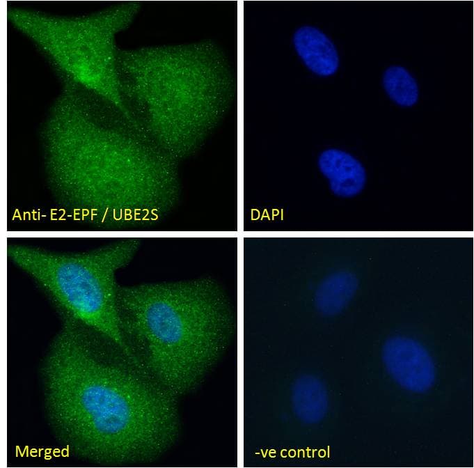 UBE2S / E2 EPF Antibody (aa2-14)