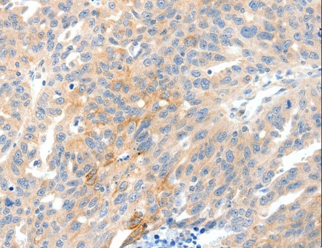 NTRK1 / TrkA Antibody