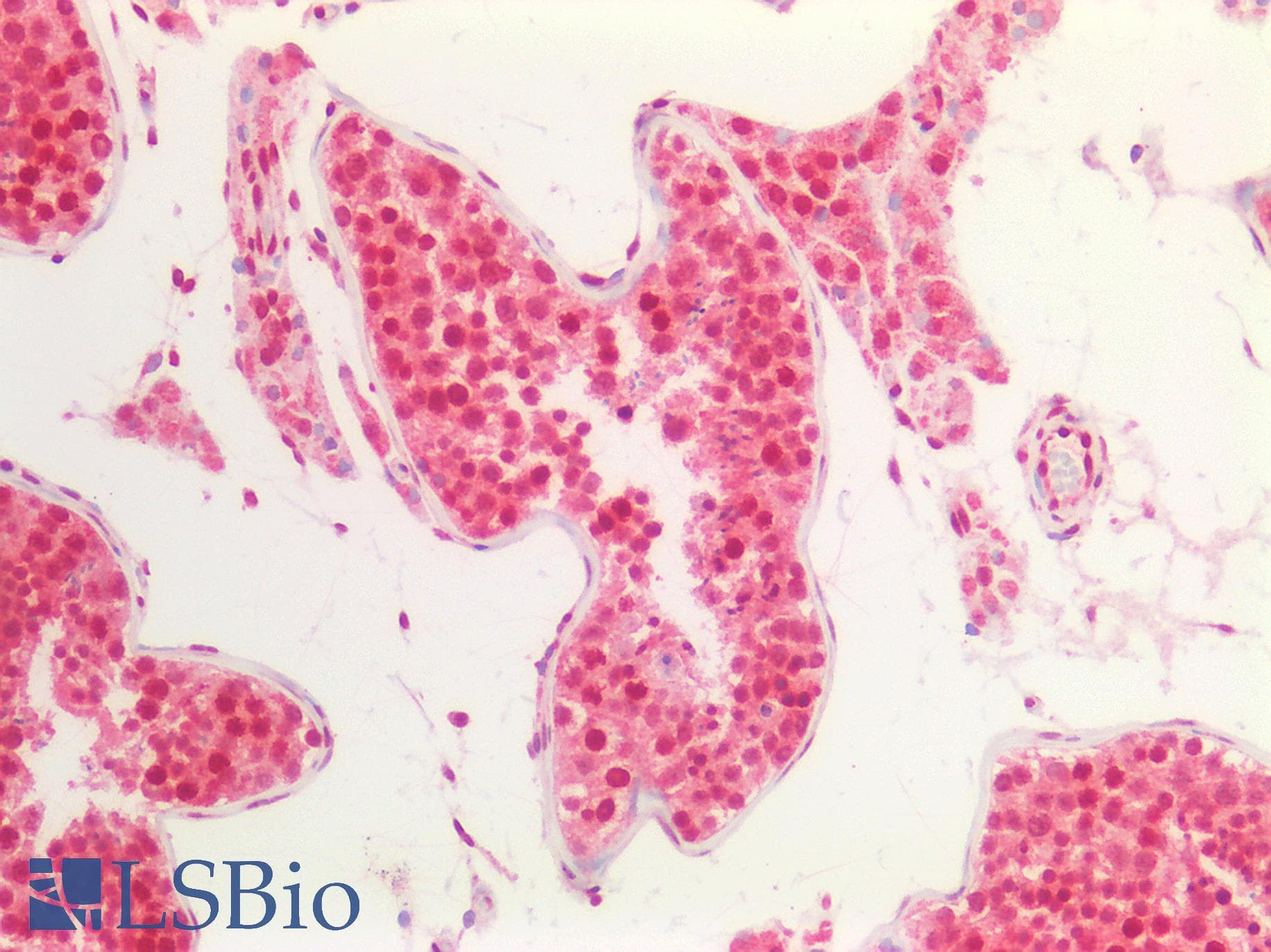 IHC-plus™ Polyclonal Rabbit anti-Human CD276 / B7-H3 Antibody (aa493-522, IHC, IF, WB)