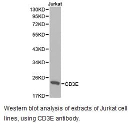 Polyclonal Rabbit anti-Human CD3E Antibody (IHC, WB)