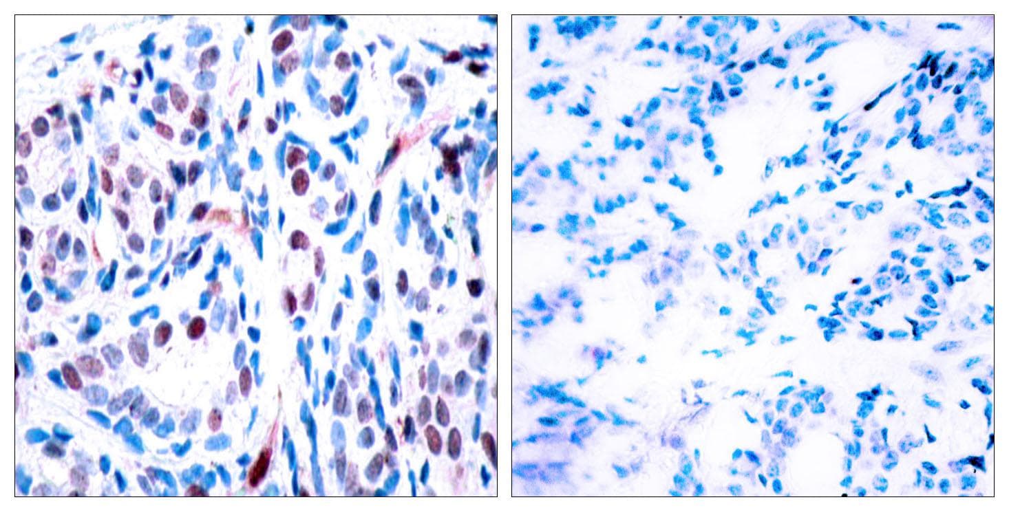STAT3 Antibody (phospho-Tyr705)