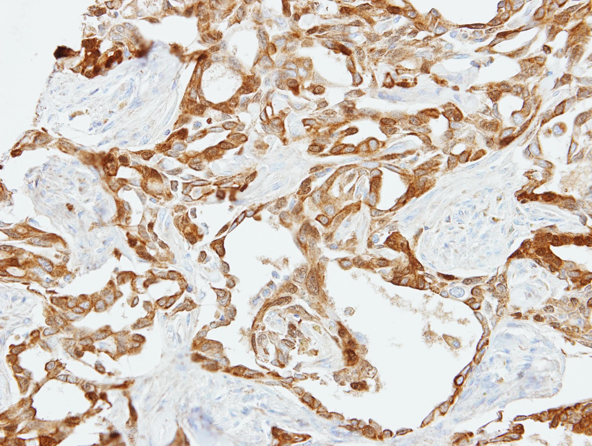 Polyclonal Rabbit anti-Human FBLN2 / Fibulin 2 Antibody (aa20-273, IHC, WB)