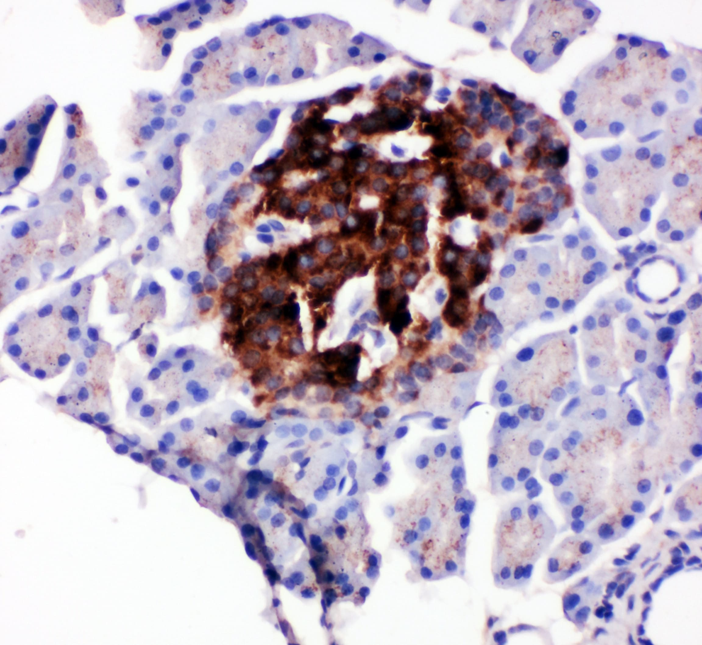 CCN4 / WISP1 Antibody (aa354-367)