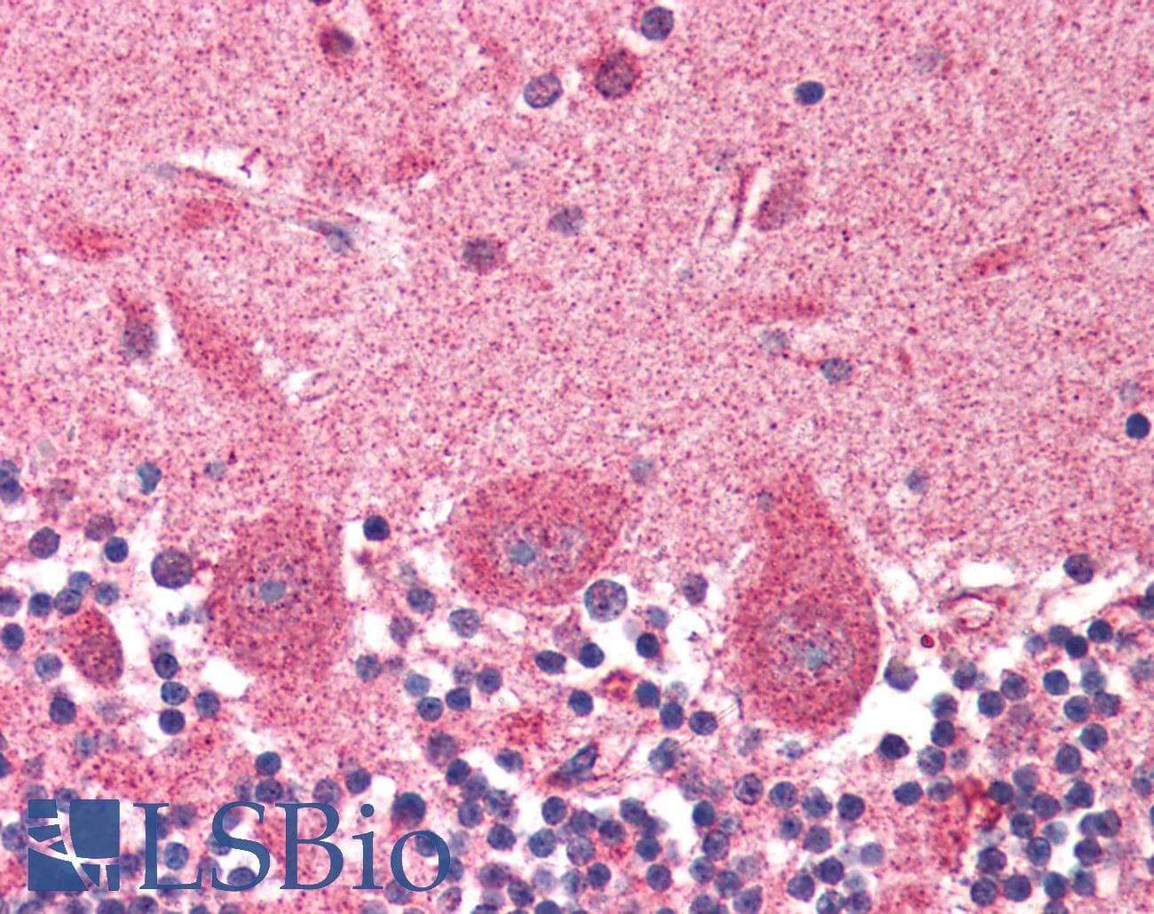 IHC-plus™ Polyclonal Goat anti-Human DCTN1 / Dynactin 1 Antibody (aa1266-1278, IHC, IF, WB)