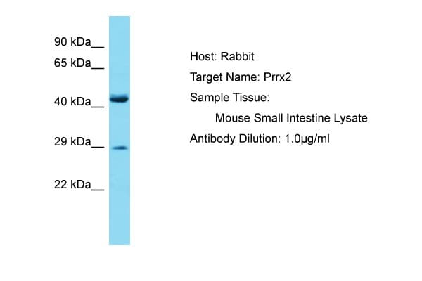 PRRX2 / PRX2 Antibody (aa151-200)