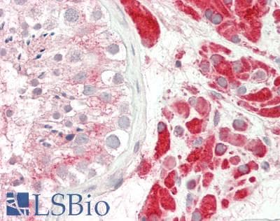IHC-plus™ Polyclonal Rabbit anti-Human PAOX / PAO Antibody (aa467-496, IHC, WB)