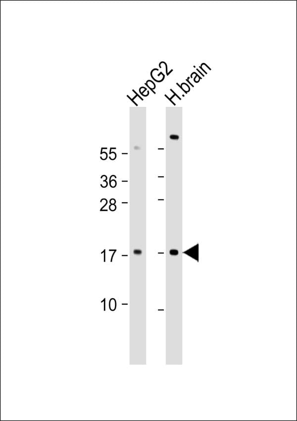 NGF Antibody