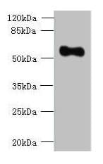Polyclonal Rabbit anti-Human OSGIN2 Antibody (IHC, WB)