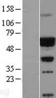 CACNB4 Protein (Over-Expression Lysate Myc-DDK (Flag))