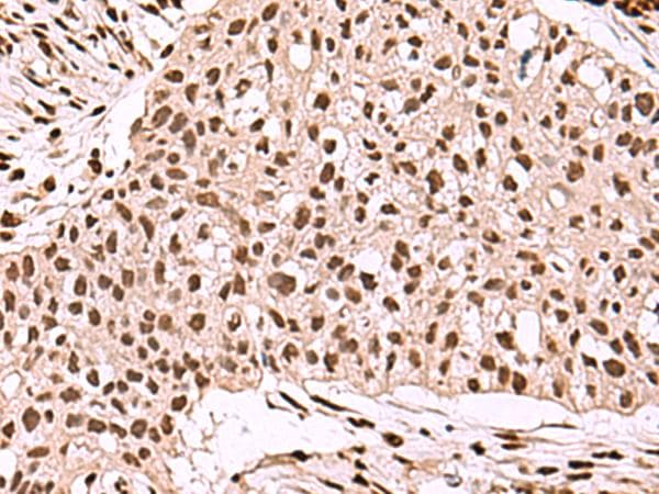 SMAD7 Antibody