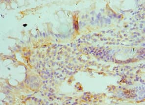 BLMH Antibody (aa1-300)