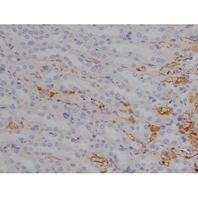 Polyclonal Rabbit anti-Human MAPT / Tau Antibody (phospho-Thr212, IHC, WB)