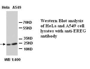 EREG / Epiregulin Antibody (Internal)