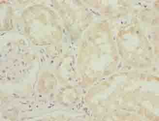 DPH6 / ATPBD4 Antibody