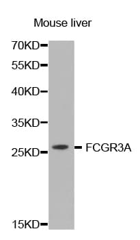 IHC-plus™ FCGR3A / CD16A Antibody