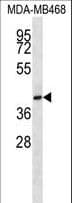 Polyclonal Rabbit anti-Human CD200R1 / CD200R Antibody (aa275-303, WB)