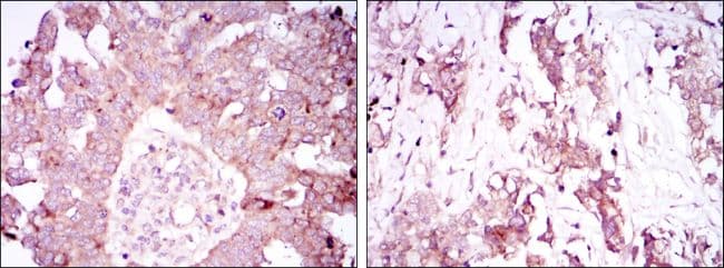ATXN1 / SCA1 Antibody (clone 2F5)
