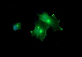 MLANA / Melan-A Antibody (clone OTI3E2, Carrier-free)