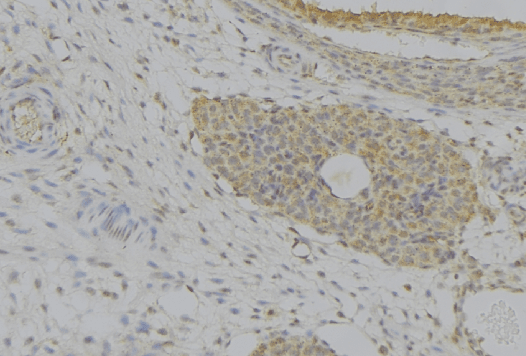 IGFBP7 / TAF Antibody