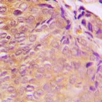 Polyclonal Rabbit anti-Human GRB10 Antibody (N-Terminus, IHC, IF, WB)