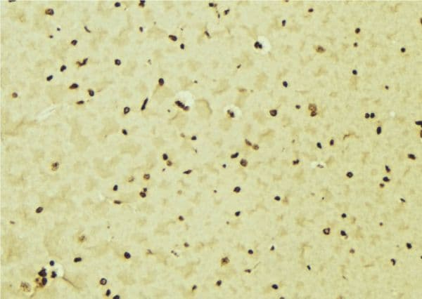 IRF5 Antibody