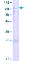 Human SOCS5 Protein (Recombinant GST)