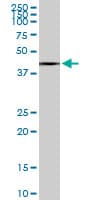 SLC25A16 / GDA / Graves Antibody (clone 1H7)